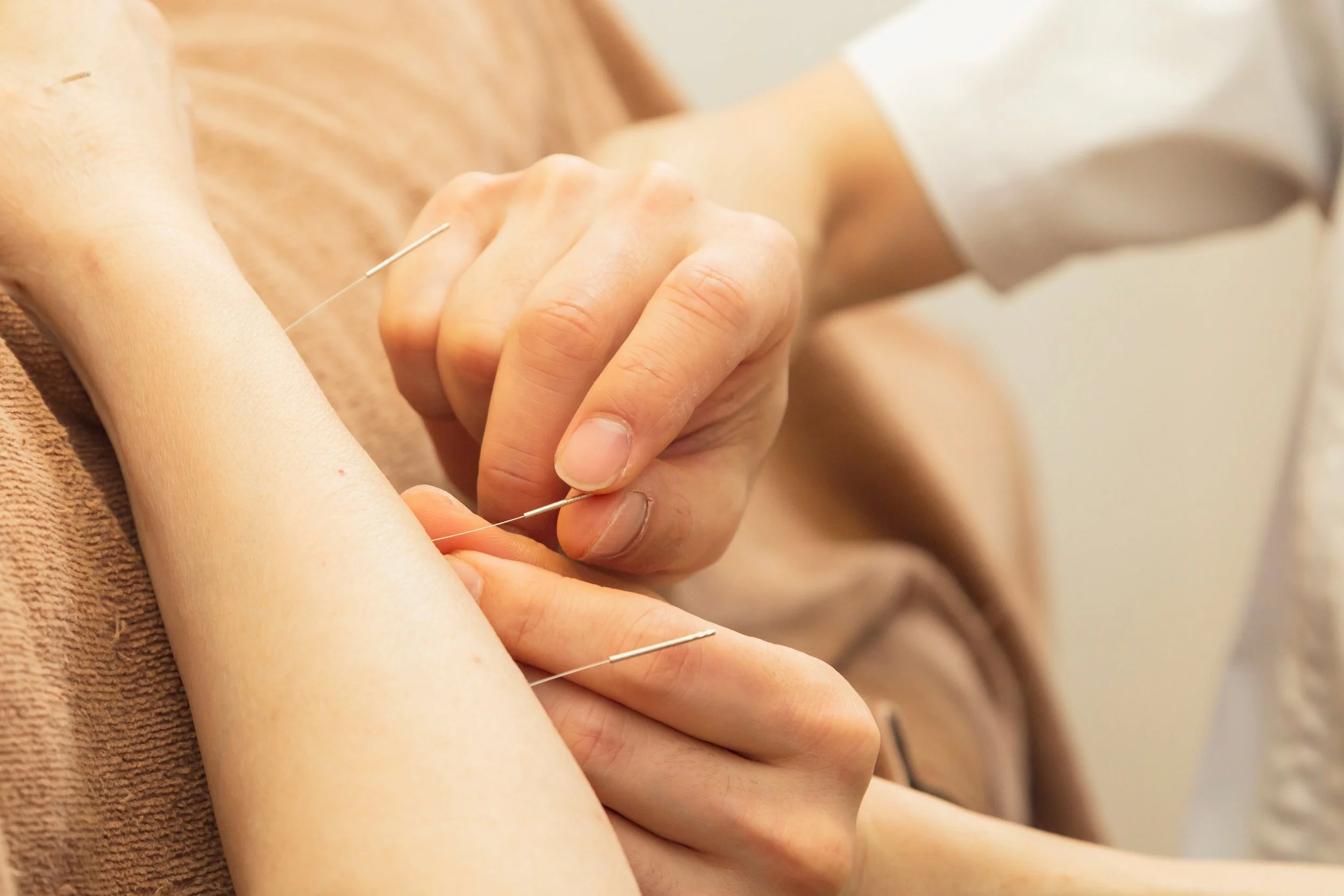 Akupunktura és relaxáció – Akupunkturbehandlungen usw módszerei