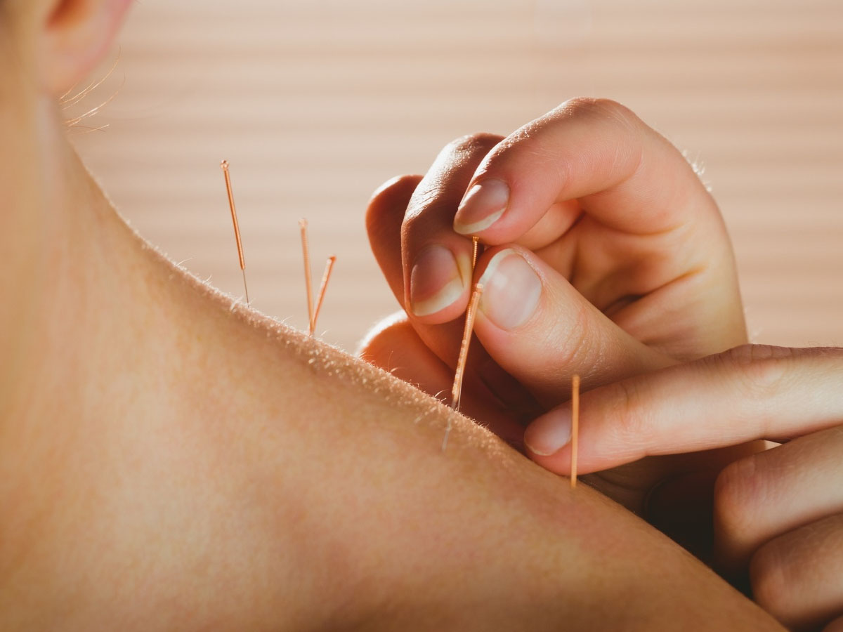 Akupunktura és relaxáció – Akupunkturbehandlungen usw módszerei