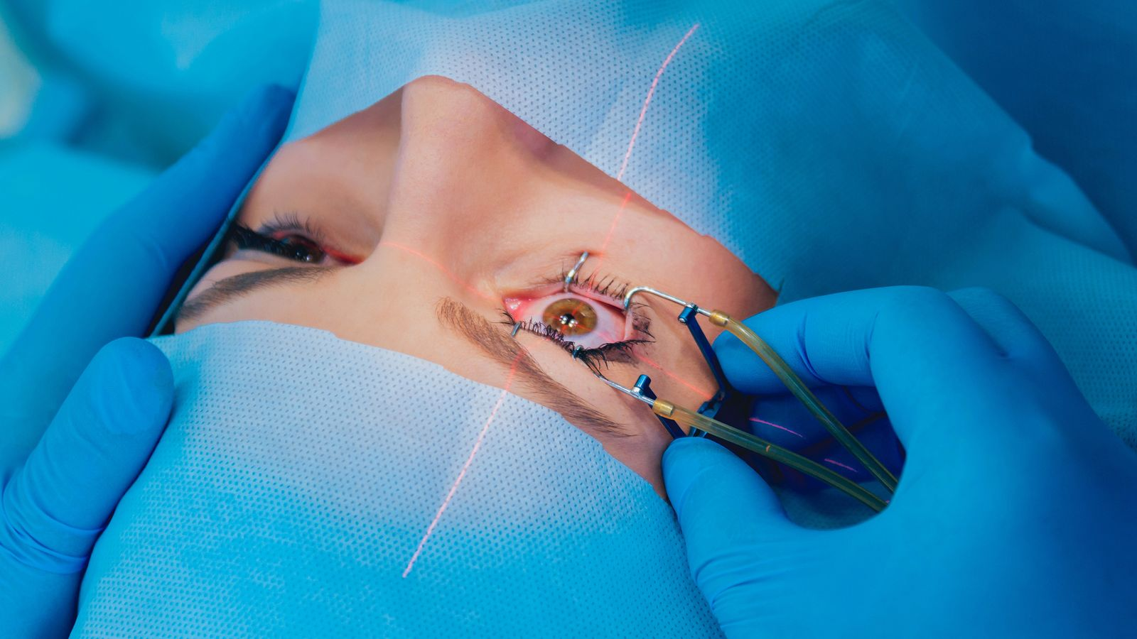 Warum Augenlasern eine langfristige Lösung für Ihre Sehprobleme sein kann